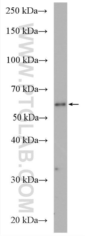 Western Blot (WB) analysis of A549 cells using PIGT Polyclonal antibody (16906-1-AP)