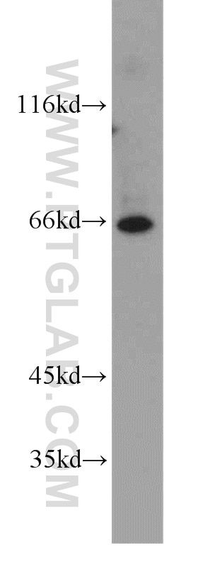 Western Blot (WB) analysis of human brain tissue using PIGT Polyclonal antibody (16906-1-AP)