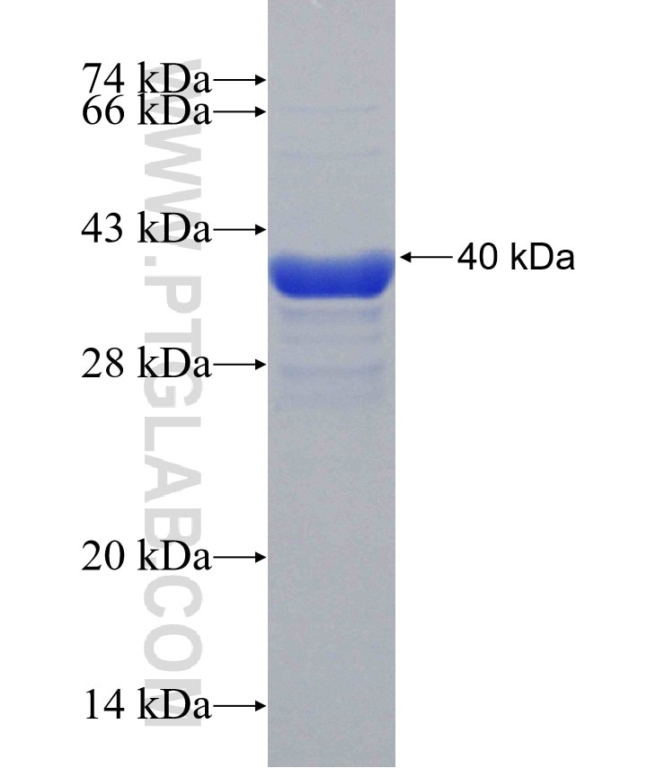 PIGT fusion protein Ag31337 SDS-PAGE PIGT fusion protein Ag31337 SDS-PAGE