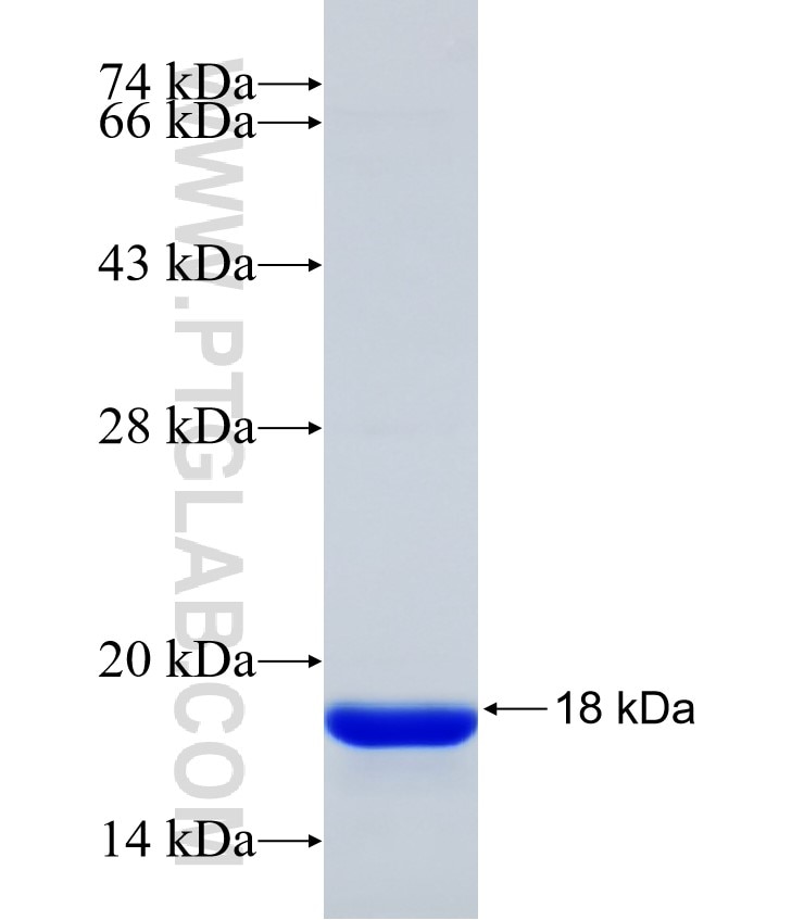 PIGT fusion protein Ag31351 SDS-PAGE PIGT fusion protein Ag31351 SDS-PAGE