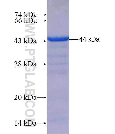 PIGT fusion protein Ag10500 SDS-PAGE