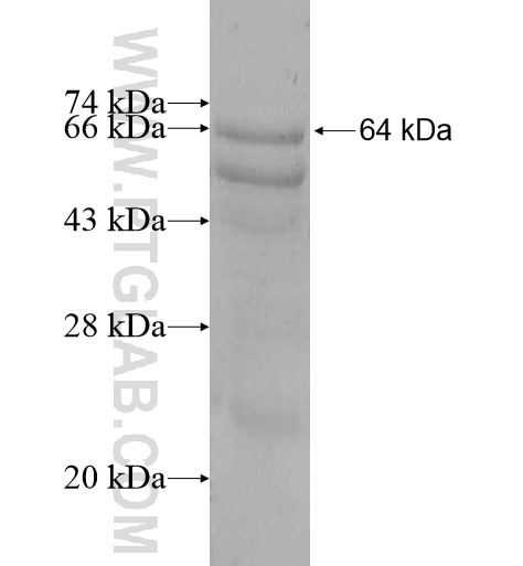 PIGT fusion protein Ag10521 SDS-PAGE