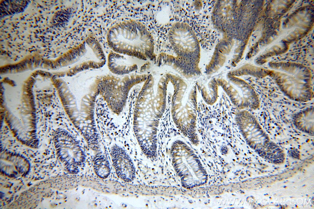 IHC staining of human colon using 17384-1-AP