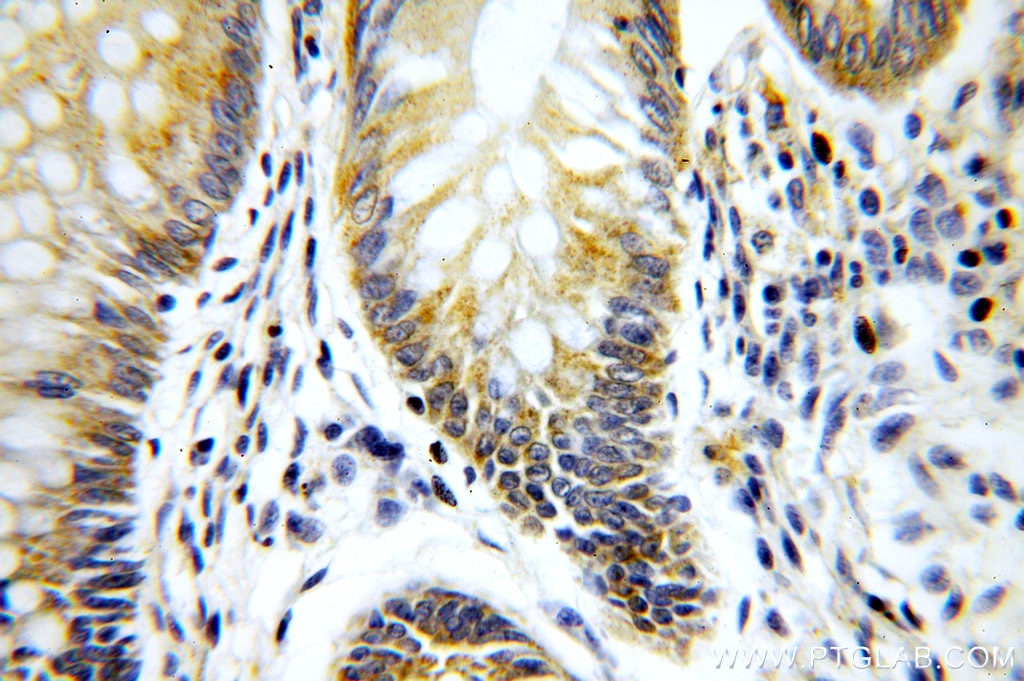 Immunohistochemistry (IHC) staining of human colon tissue using PIGZ Polyclonal antibody (17384-1-AP)