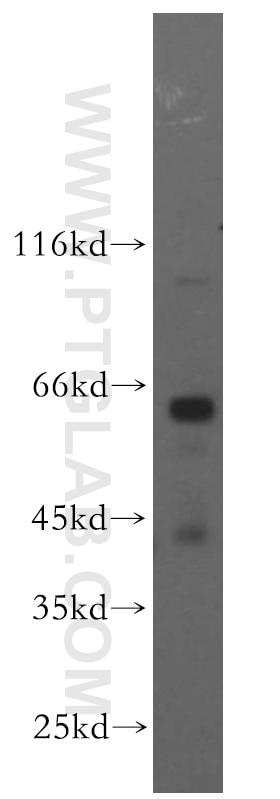 Western Blot (WB) analysis of human brain tissue using PIGZ Polyclonal antibody (17384-1-AP)