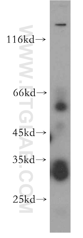 Western Blot (WB) analysis of HEK-293 cells using PIGZ Polyclonal antibody (17384-1-AP)