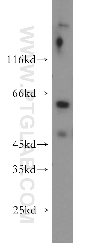 Western Blot (WB) analysis of human testis tissue using PIGZ Polyclonal antibody (17384-1-AP)