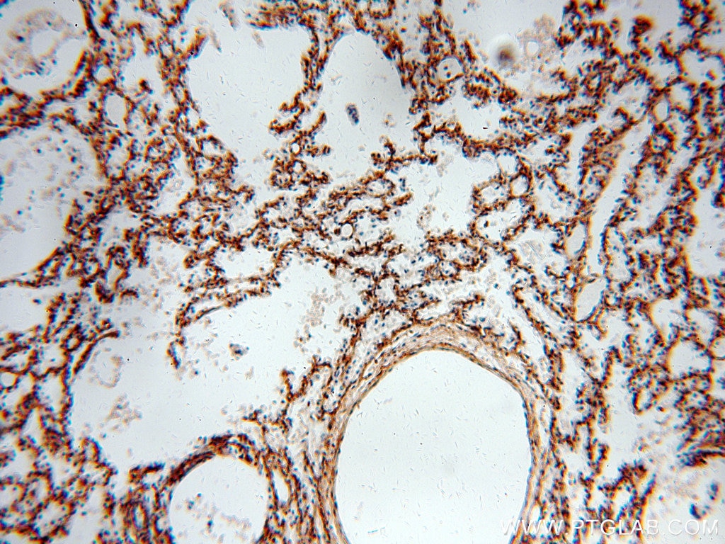 Immunohistochemistry (IHC) staining of human lung tissue using PIH1D1 Polyclonal antibody (19427-1-AP)