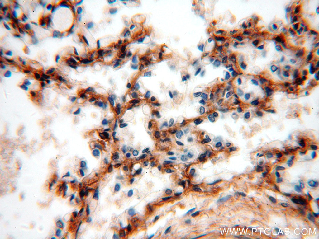 IHC staining of human lung using 19427-1-AP