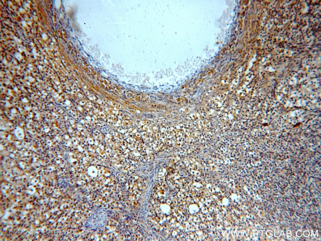 IHC staining of human ovary using 19427-1-AP