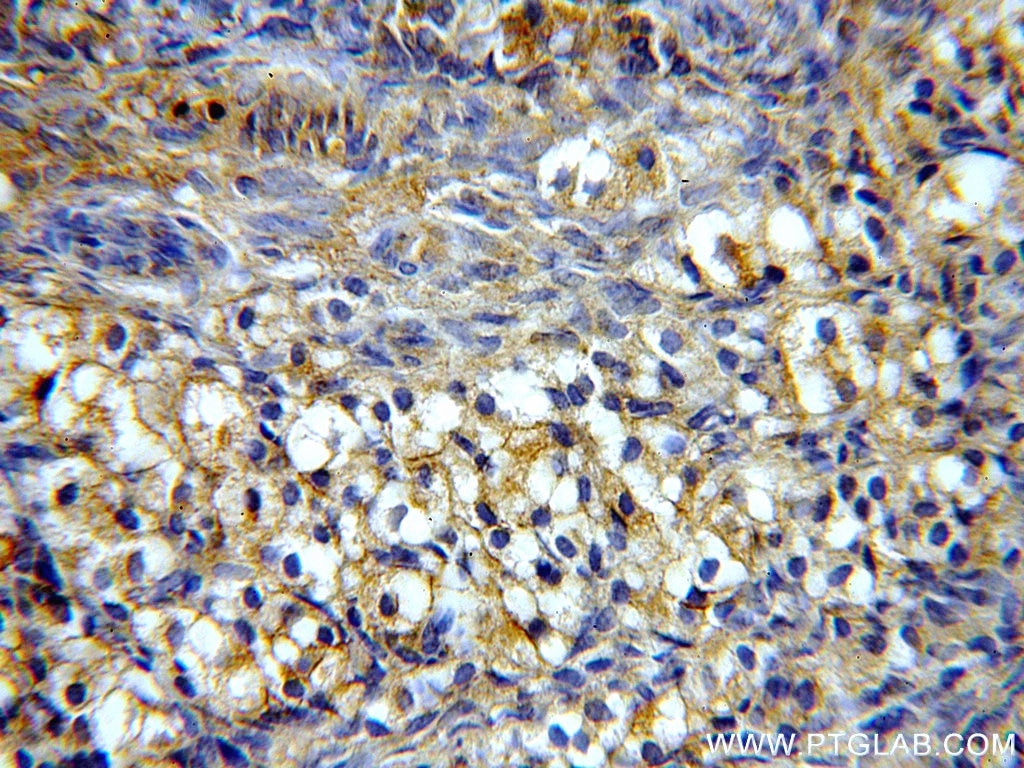 Immunohistochemistry (IHC) staining of human ovary tissue using PIH1D1 Polyclonal antibody (19427-1-AP)