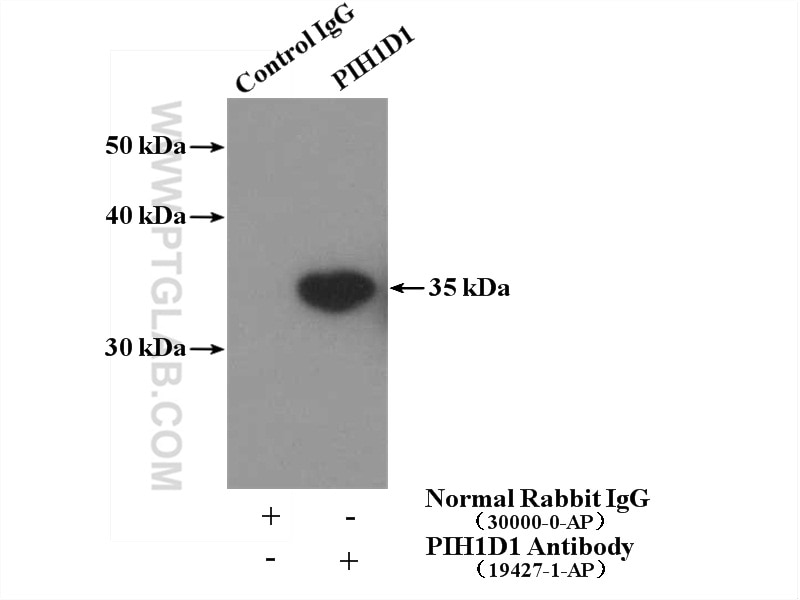 Immunoprecipitation (IP) experiment of HeLa cells using PIH1D1 Polyclonal antibody (19427-1-AP)