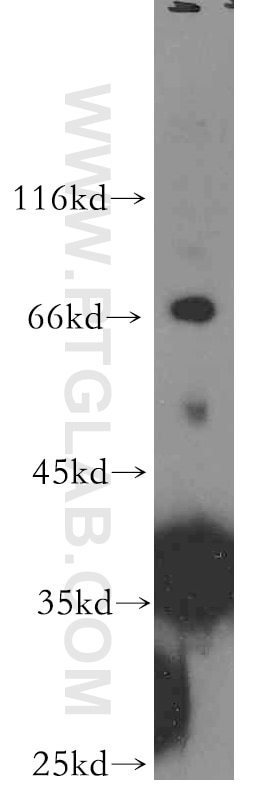 Western Blot (WB) analysis of human testis tissue using PIH1D1 Polyclonal antibody (19427-1-AP)
