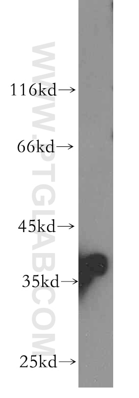 Western Blot (WB) analysis of mouse ovary tissue using PIH1D1 Polyclonal antibody (19427-1-AP)