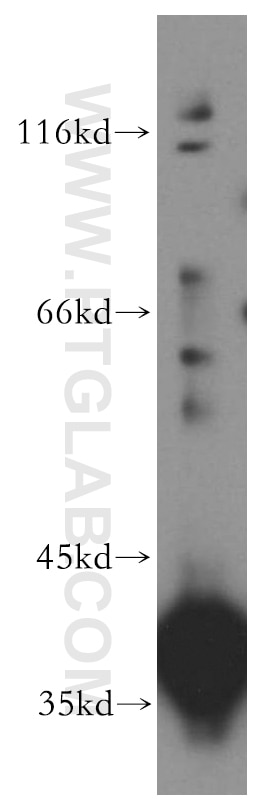 Western Blot (WB) analysis of A431 cells using PIH1D1 Polyclonal antibody (19427-1-AP)