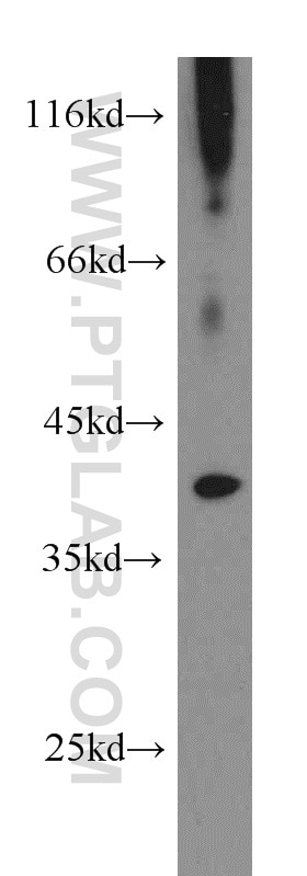 Western Blot (WB) analysis of mouse eye tissue using PIH1D1 Polyclonal antibody (19427-1-AP)
