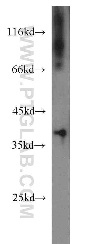 Western Blot (WB) analysis of human uterus tissue using PIH1D1 Polyclonal antibody (19427-1-AP)