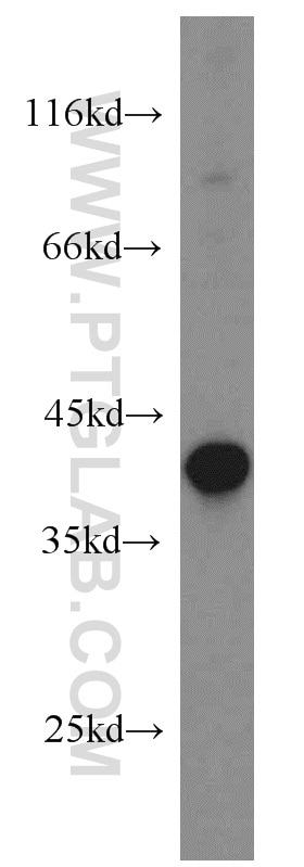 Western Blot (WB) analysis of HeLa cells using PIH1D1 Polyclonal antibody (19427-1-AP)