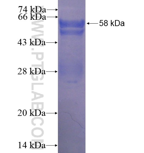 PIH1D1 fusion protein Ag13759 SDS-PAGE