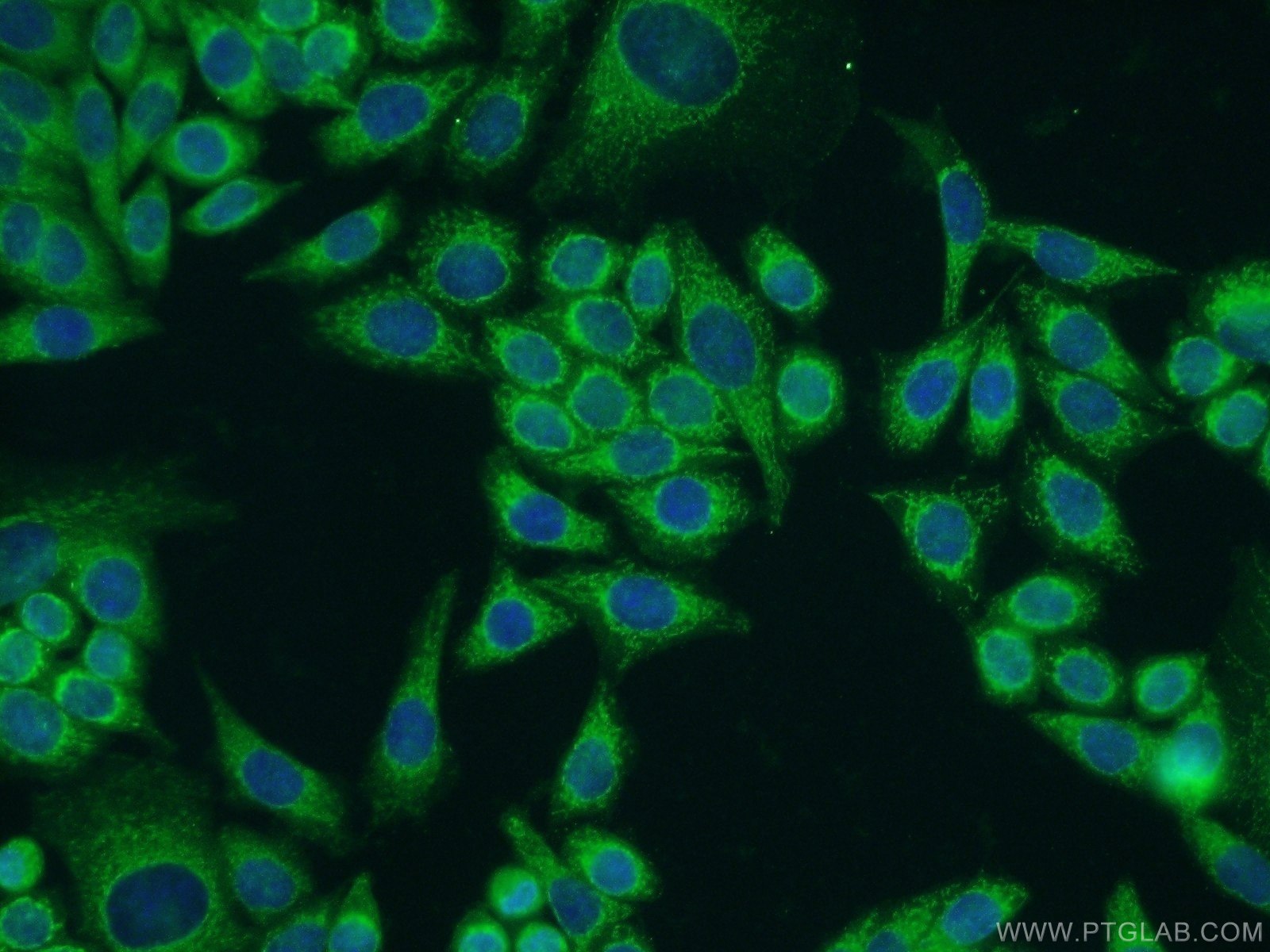 Immunofluorescence (IF) / fluorescent staining of HeLa cells using PIK3C2A Polyclonal antibody (22028-1-AP)