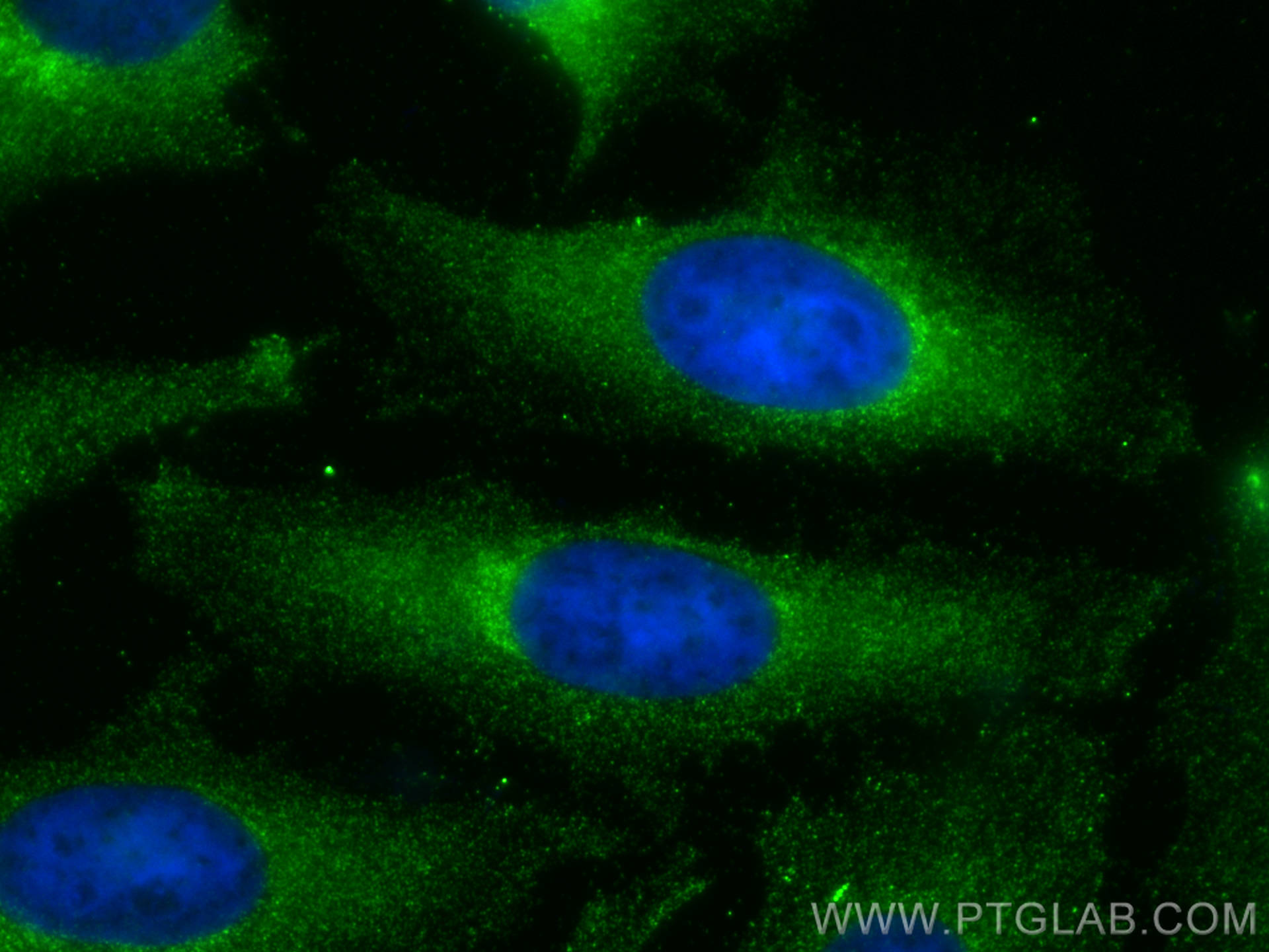 Immunofluorescence (IF) / fluorescent staining of HeLa cells using PIK3C2A Polyclonal antibody (22028-1-AP)