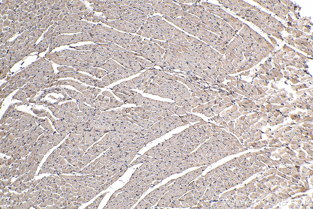 Immunohistochemistry (IHC) staining of mouse heart tissue using PIK3C2A Polyclonal antibody (22028-1-AP)