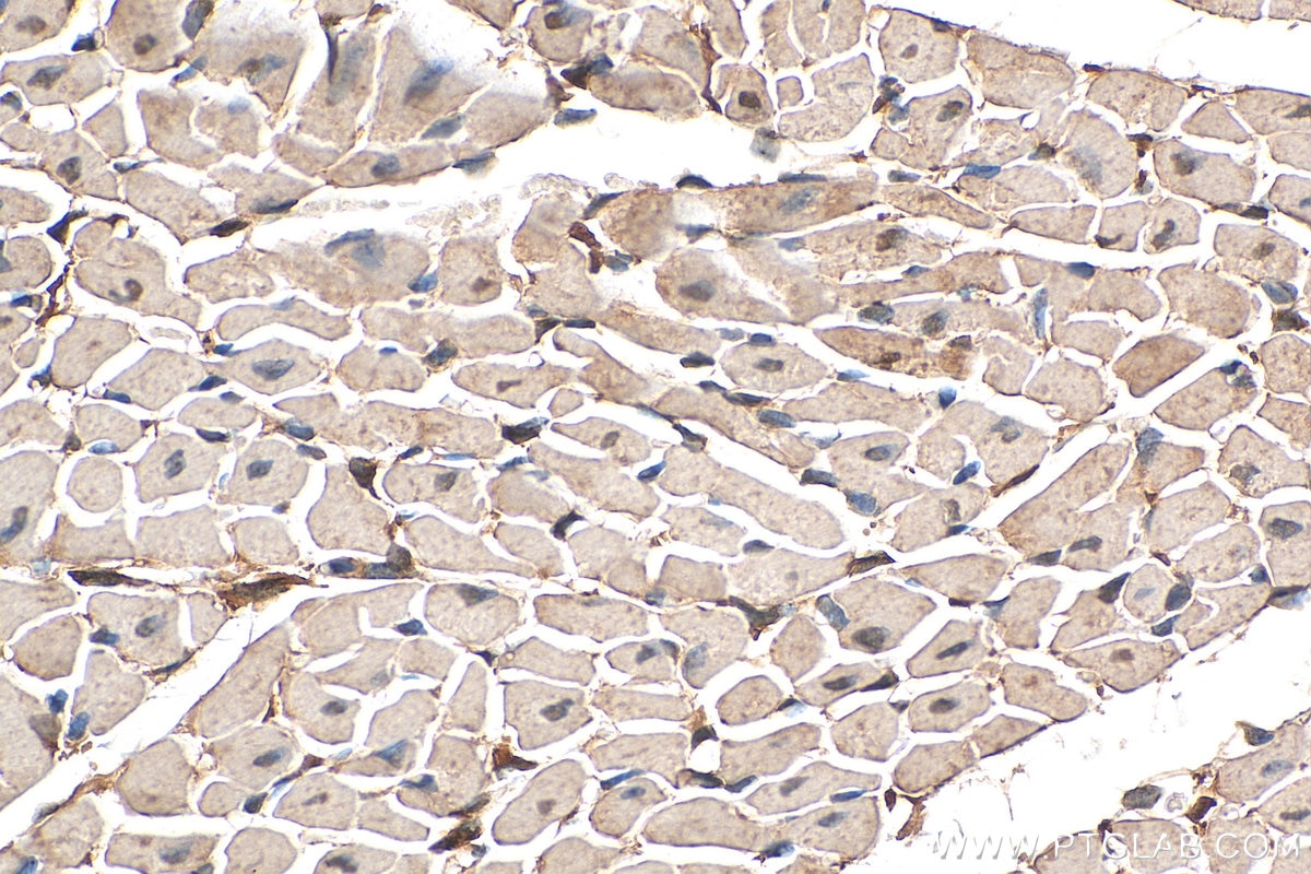 Immunohistochemistry (IHC) staining of mouse heart tissue using PIK3C2A Polyclonal antibody (22028-1-AP)