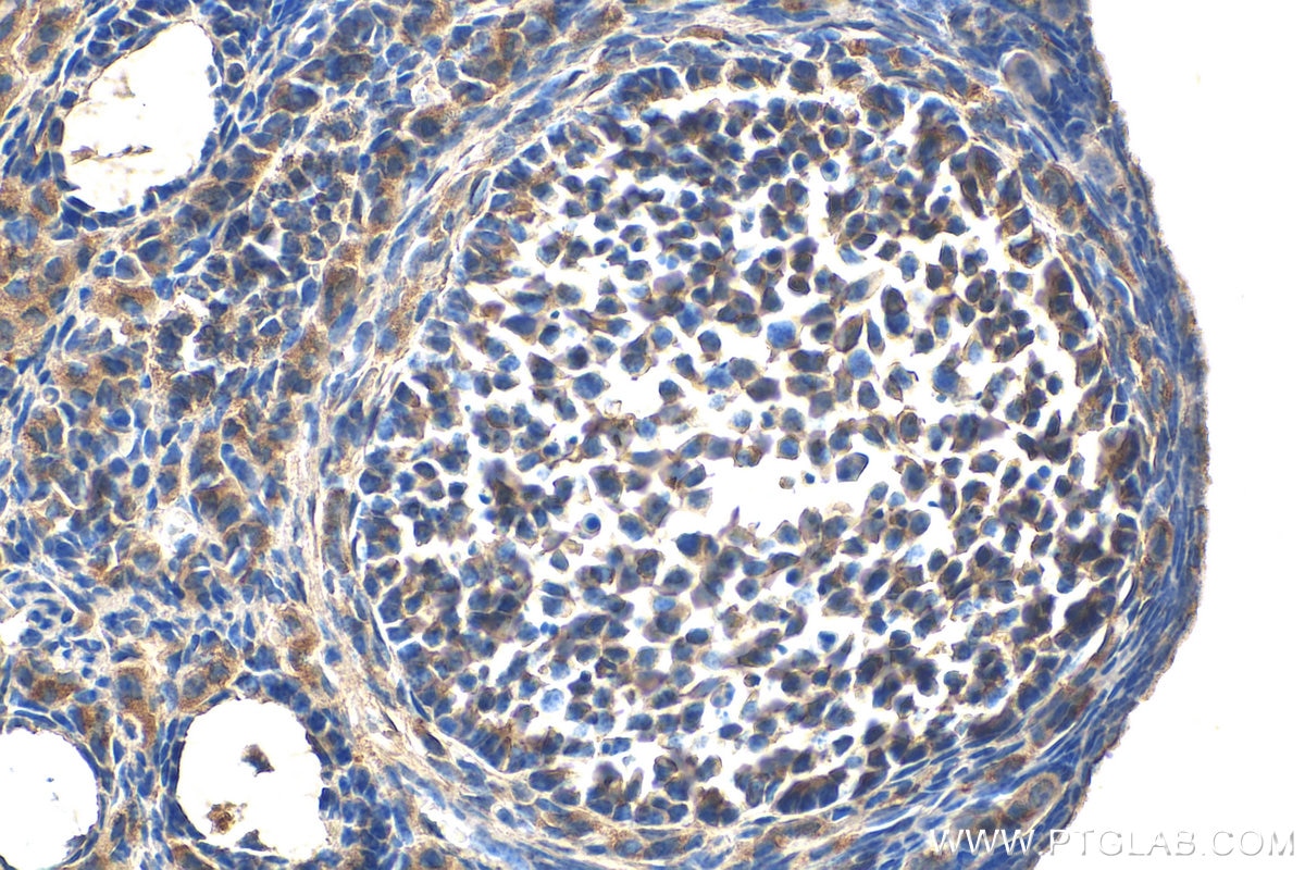 Immunohistochemistry (IHC) staining of mouse ovary tissue using PIK3C2A Polyclonal antibody (22028-1-AP)