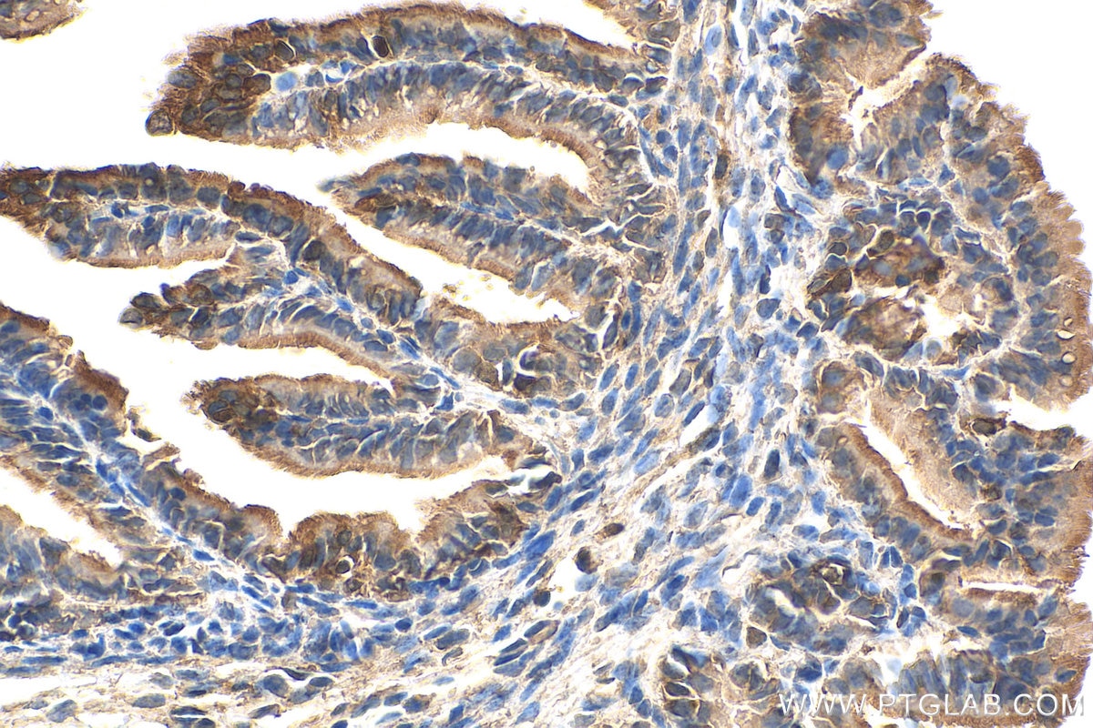 Immunohistochemistry (IHC) staining of mouse ovary tissue using PIK3C2A Polyclonal antibody (22028-1-AP)