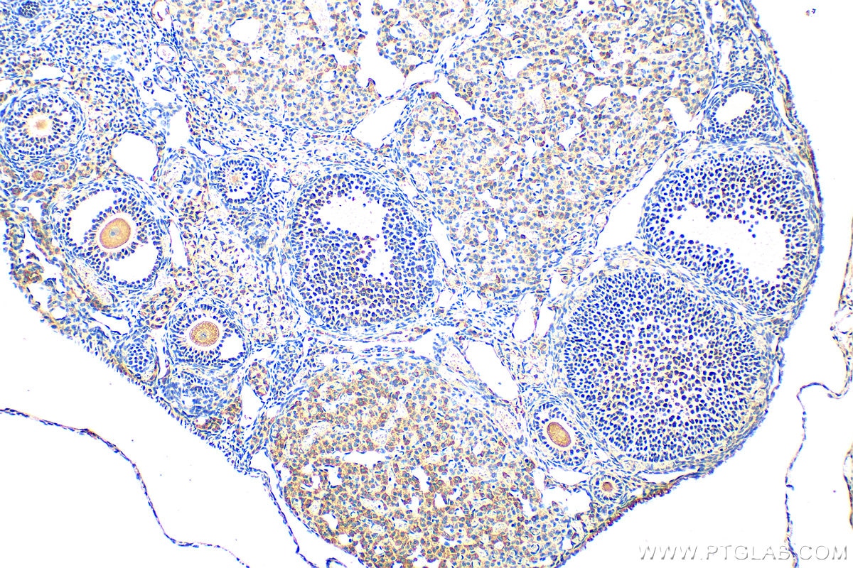 Immunohistochemistry (IHC) staining of mouse ovary tissue using PIK3C2A Polyclonal antibody (22028-1-AP)
