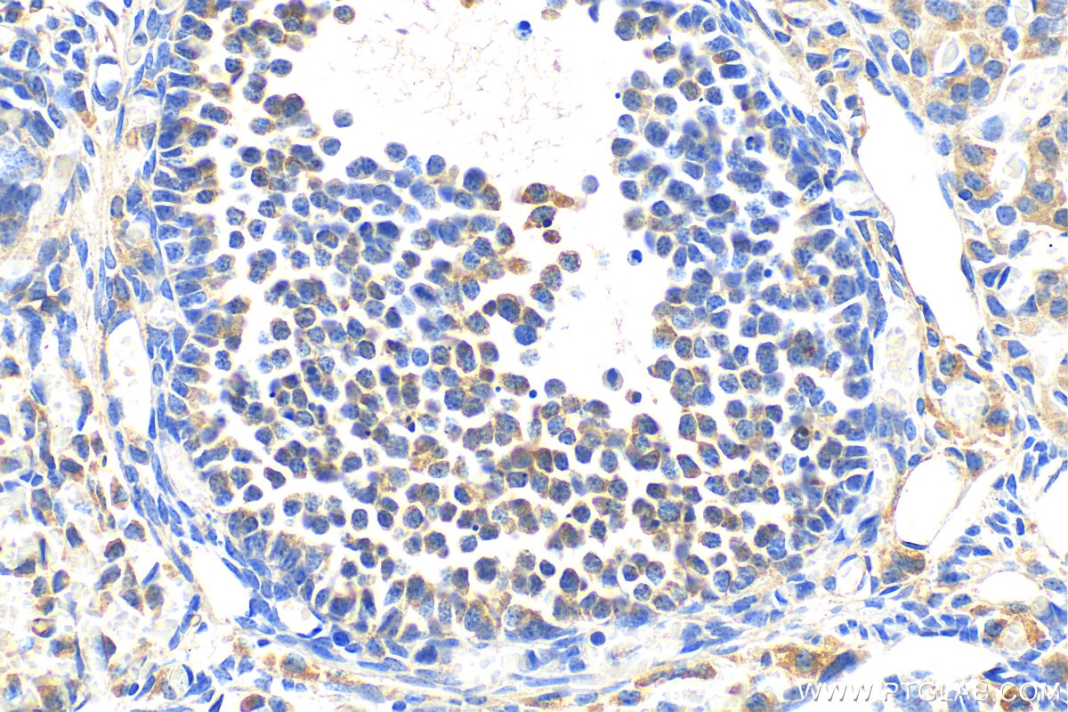Immunohistochemistry (IHC) staining of mouse ovary tissue using PIK3C2A Polyclonal antibody (22028-1-AP)