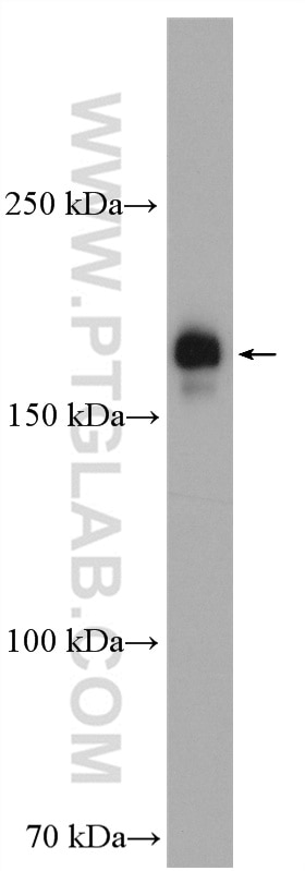 Western Blot (WB) analysis of HeLa cells using PIK3C2A Polyclonal antibody (22028-1-AP)