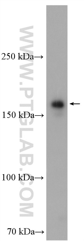 Western Blot (WB) analysis of PC-3 cells using PIK3C2A Polyclonal antibody (22028-1-AP)