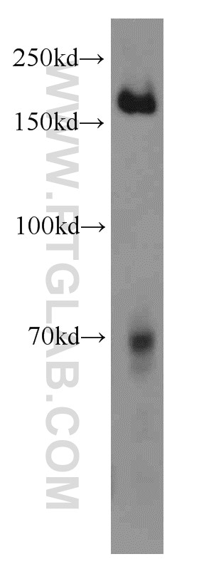 WB analysis of human placenta using 22028-1-AP