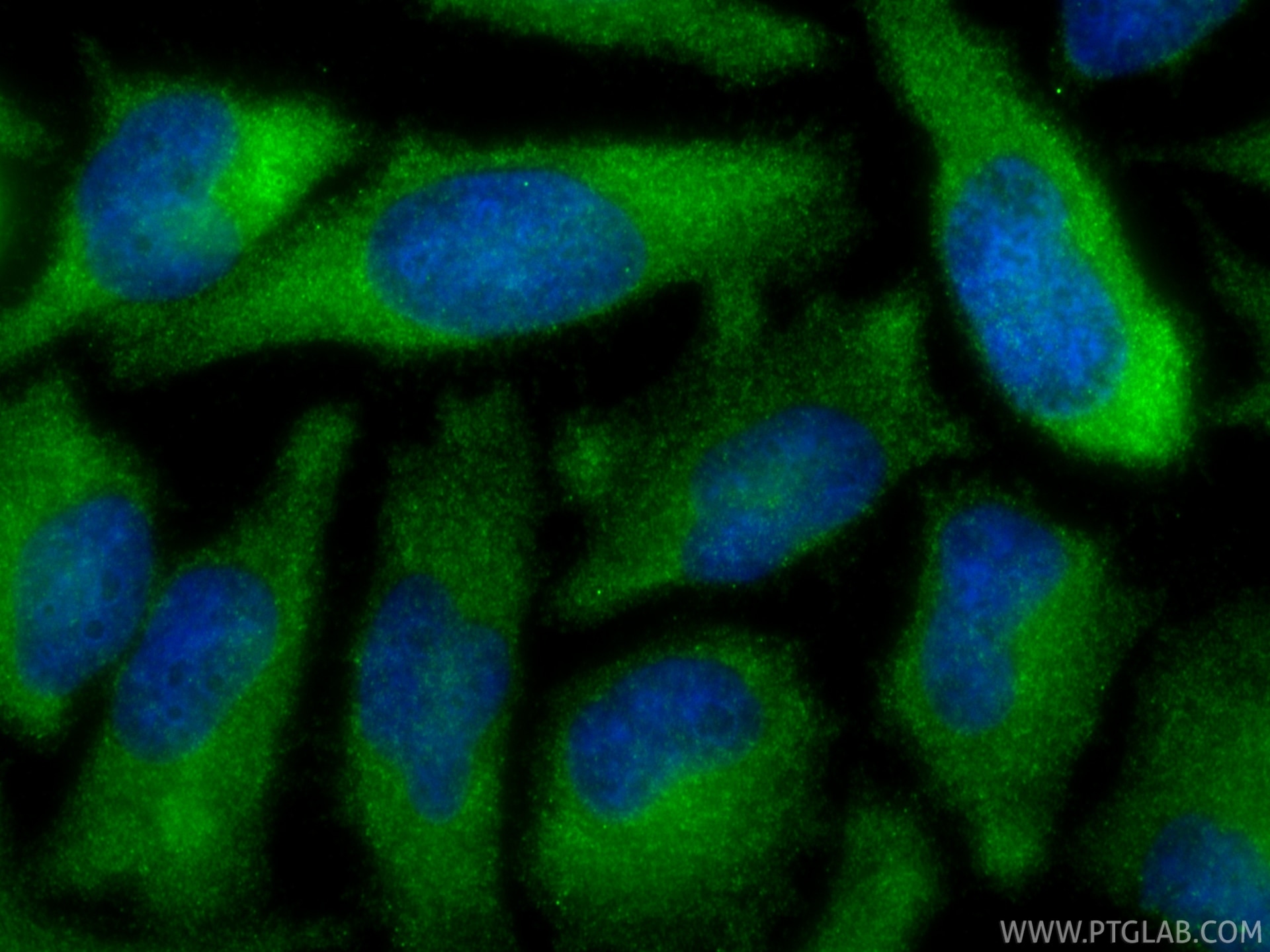 IF Staining of HeLa using 88380-1-RR Immunofluorescence (IF) / fluorescent staining of HeLa cells using PIK3C2A Recombinant monoclonal antibody (88380-1-RR)