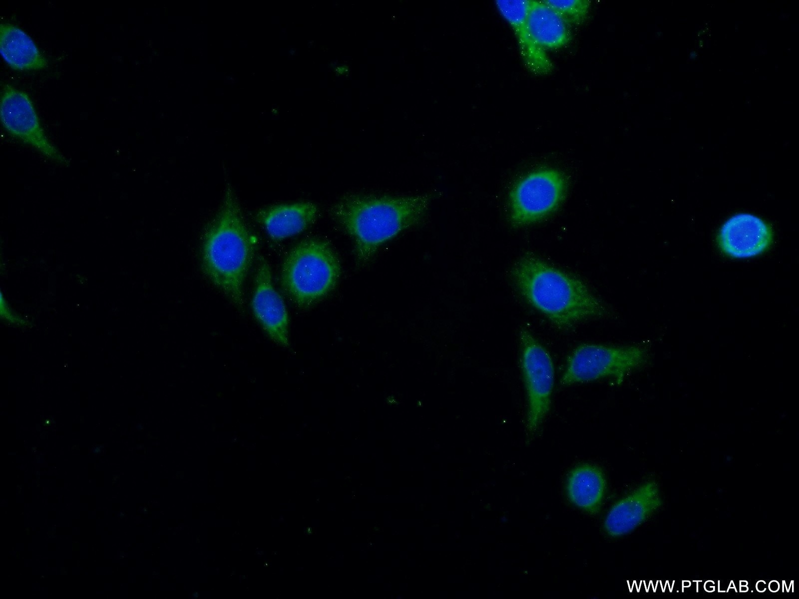 Immunofluorescence (IF) / fluorescent staining of HeLa cells using PIK3C2B Polyclonal antibody (24788-1-AP)