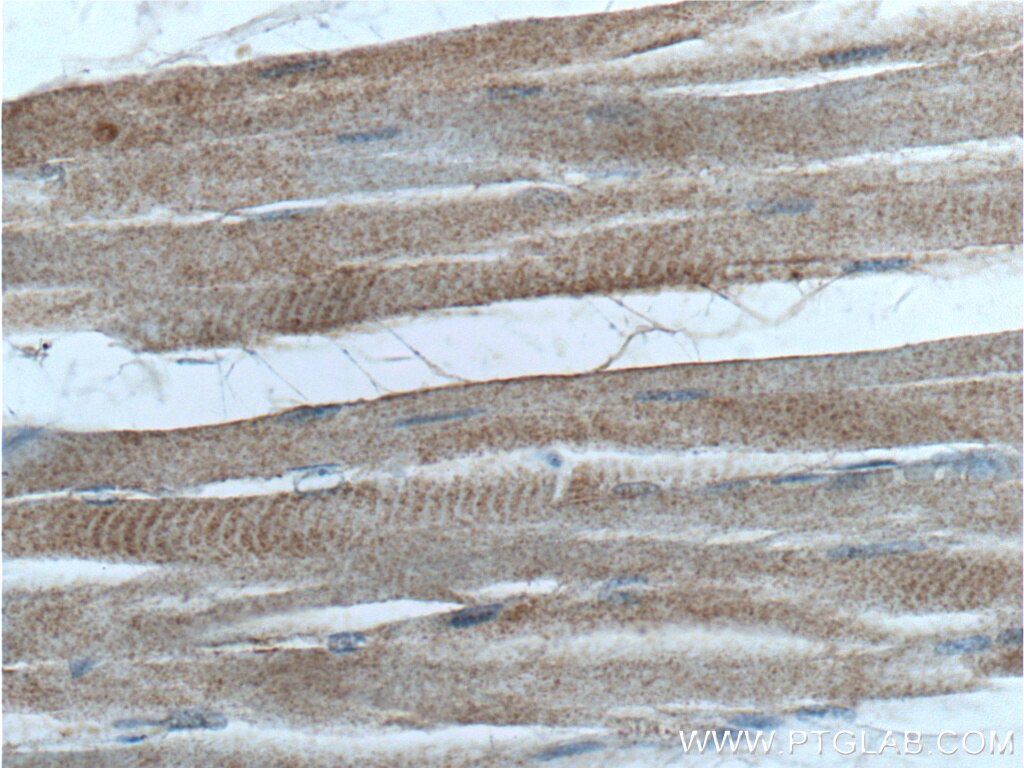 Immunohistochemistry (IHC) staining of human skeletal muscle tissue using PIK3C2B Polyclonal antibody (24788-1-AP)