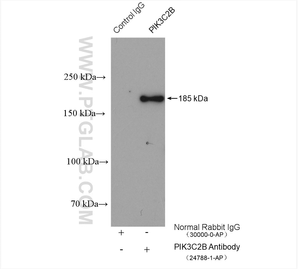 Immunoprecipitation (IP) experiment of HeLa cells using PIK3C2B Polyclonal antibody (24788-1-AP)