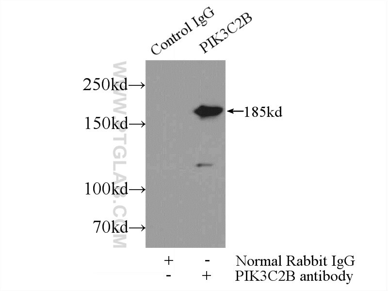 Immunoprecipitation (IP) experiment of HeLa cells using PIK3C2B Polyclonal antibody (24788-1-AP)