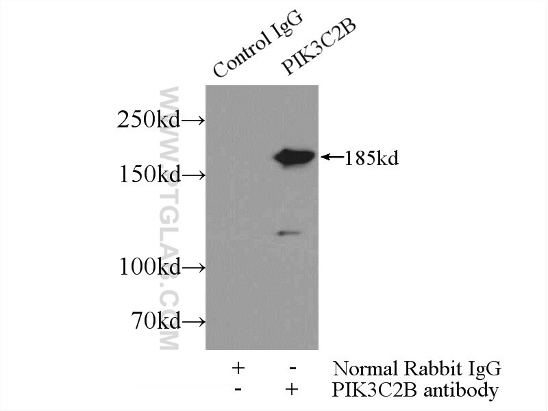 IP experiment of HeLa using 24788-1-AP