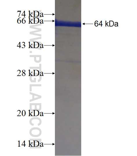 PIK3C2B fusion protein Ag20474 SDS-PAGE