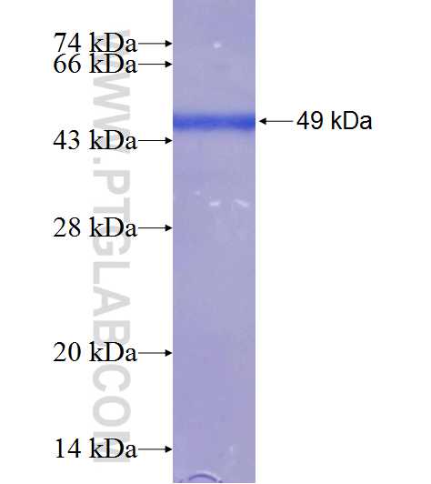 PIK3C2B fusion protein Ag20478 SDS-PAGE