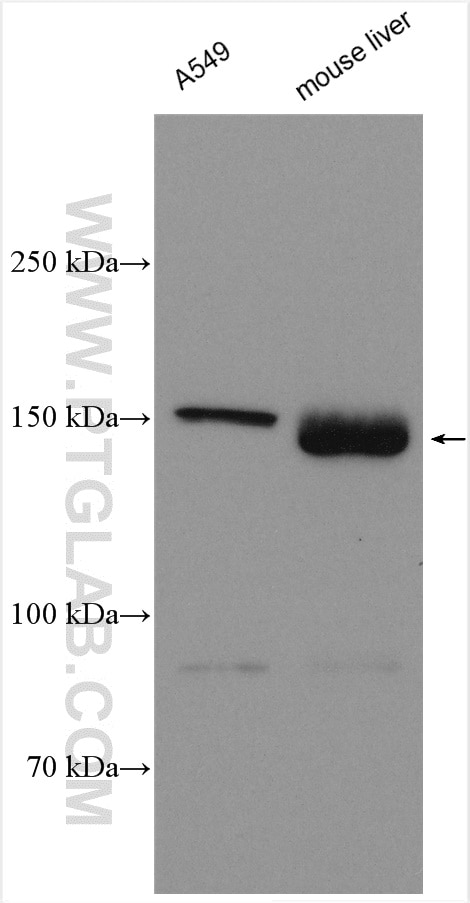 Western Blot (WB) analysis of various lysates using PIK3C2G Polyclonal antibody (25904-1-AP)