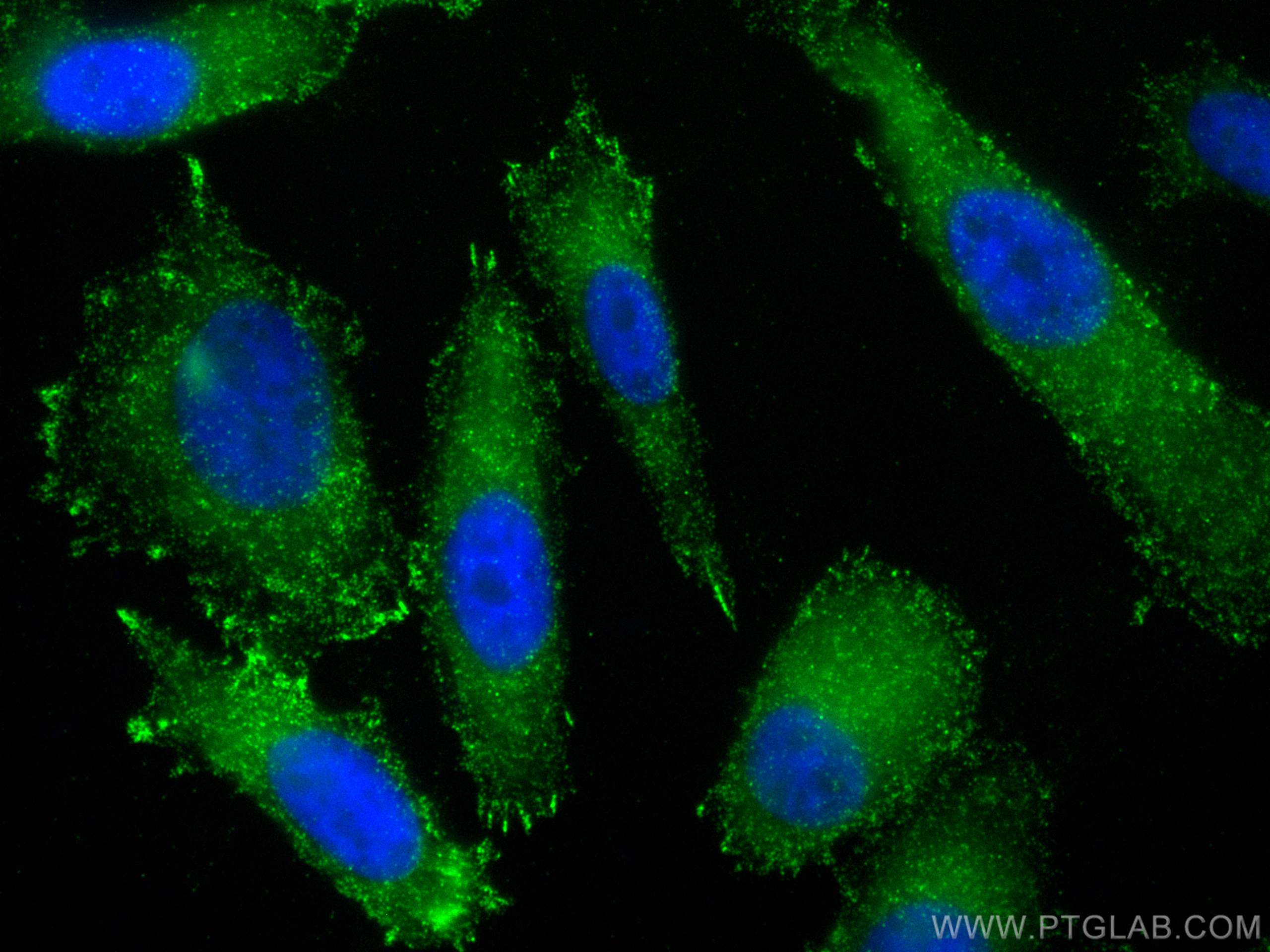 Immunofluorescence (IF) / fluorescent staining of PC-3 cells using VPS34 (C terminal) Polyclonal antibody (12452-1-AP)