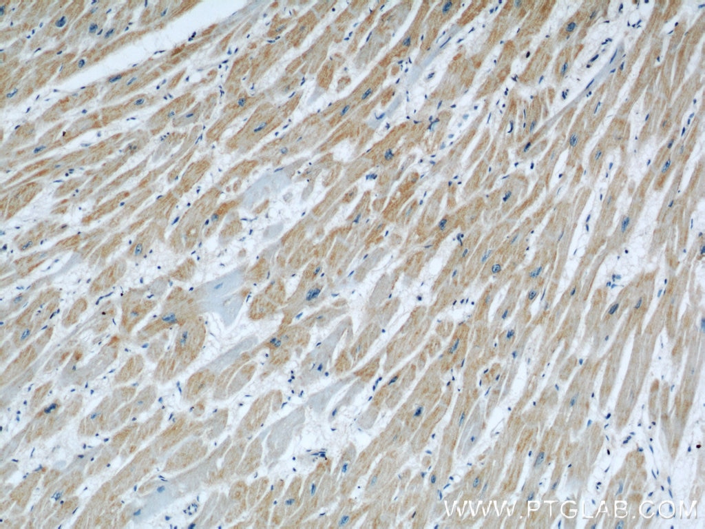 Immunohistochemistry (IHC) staining of human heart tissue using VPS34 (C terminal) Polyclonal antibody (12452-1-AP)