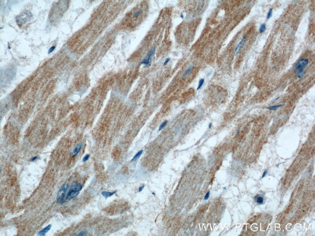 Immunohistochemistry (IHC) staining of human heart tissue using VPS34 (C terminal) Polyclonal antibody (12452-1-AP)