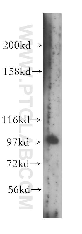 Western Blot (WB) analysis of human brain tissue using VPS34 (C terminal) Polyclonal antibody (12452-1-AP)