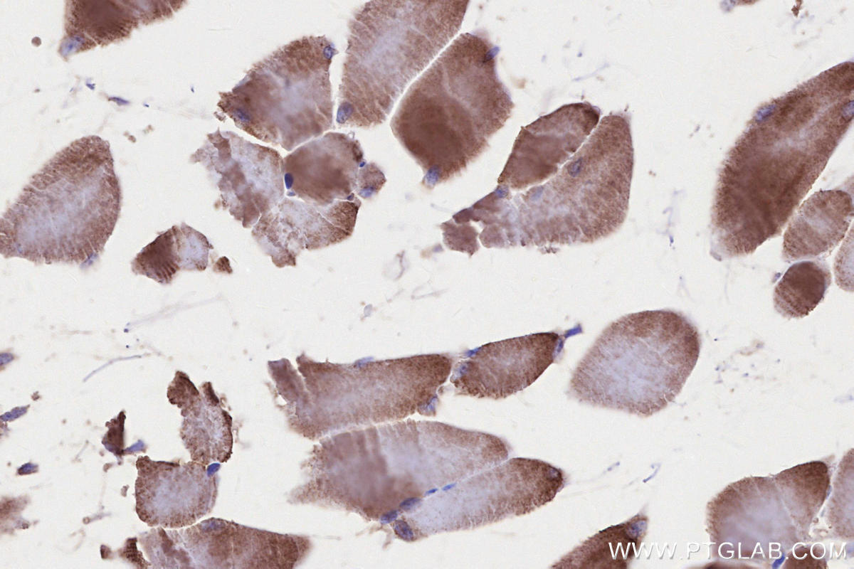 Immunohistochemistry (IHC) staining of mouse skeletal muscle tissue using VPS34 Polyclonal antibody (13723-1-AP)