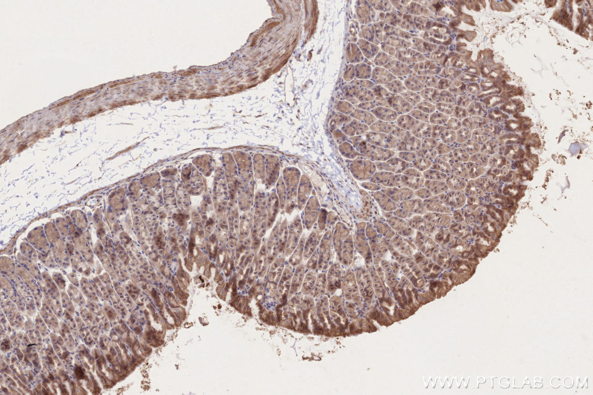 Immunohistochemistry (IHC) staining of mouse stomach tissue using VPS34 Polyclonal antibody (13723-1-AP)