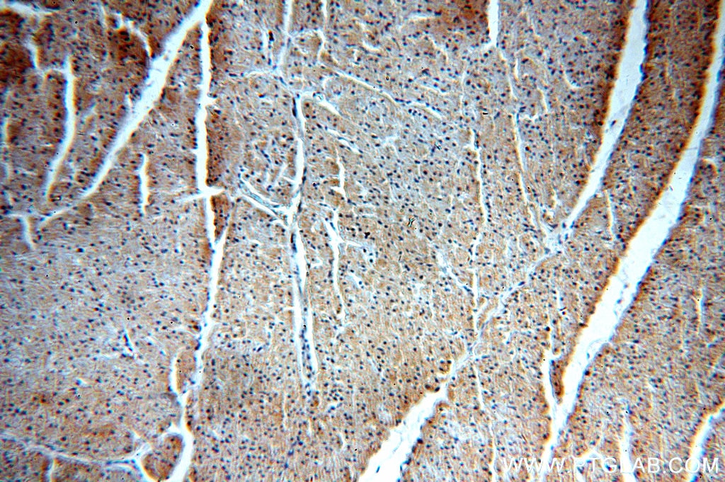 Immunohistochemistry (IHC) staining of human heart tissue using VPS34 Polyclonal antibody (13723-1-AP)